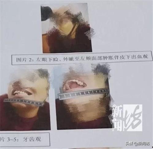 女生暴力吃瓜视频大全,全网热议！